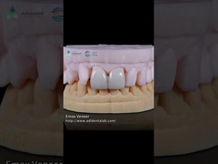 Doğal Baskılı EMAX Finer Dayanıklılığı 16 Renkleri Emax Diş Finerleri