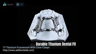 3D Titanyum Dental Çerçeve Şeffaf Klipsler