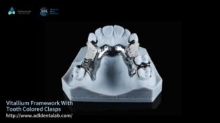 Vitallium Çerçeve Doğal Estetik Kolay Uyum