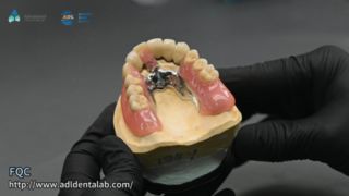 Teleskop Taç Hassas Lehimleme Kalitesi