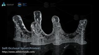 Diş Gıcırdatma Rahatlaması için Özel 3D Baskılı Gece Koruması