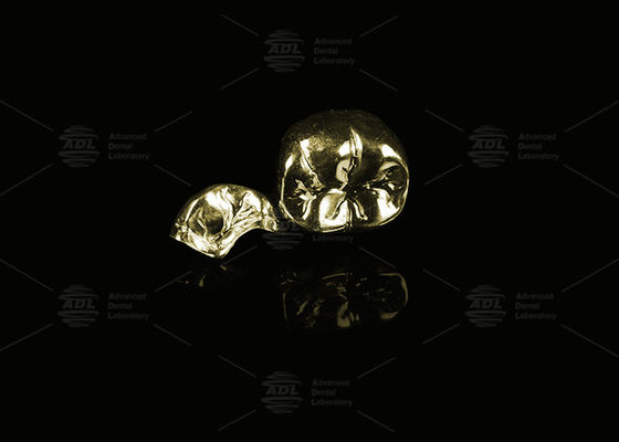 satın al Değerli Alaşım Sarı Altın % 60 Tam Metal Taç Altın Finish Tam Metal Taç Çevrimiçi üretim