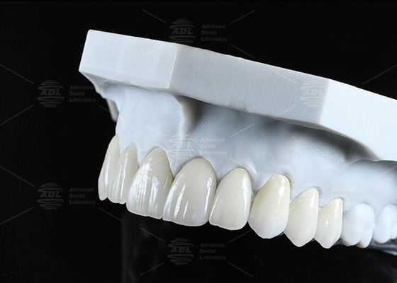 satın al Translucence CAD EMAX Finer Ön Arka Bölgeler için Polişlenmiş Camlı Seramik Restorasyonlar Çevrimiçi üretim