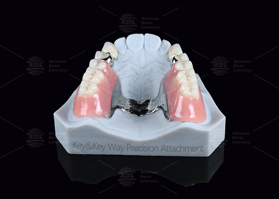 satın al Gümüş Anahtar ve Anahtar Yolu Bağlantısı Temizlik kolaylık Sağlıklı Bağlantı Dental Çevrimiçi üretim