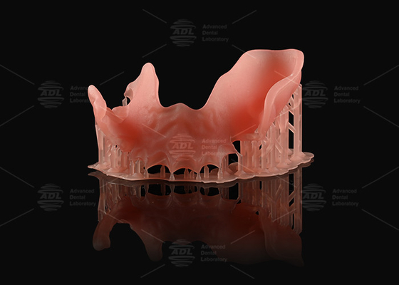 satın al Turuncu Pembe Akrilik Kısmi Diş Protezi Doğal Görünümlü 3D Baskı Dijital Diş Protezleri Çevrimiçi üretim