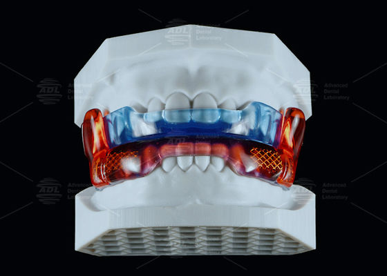 satın al Tıbbi Kaliteli Silikon Anti Horlama Aygıtı RP Uykuyu Artırmak İçin Çevrimiçi üretim