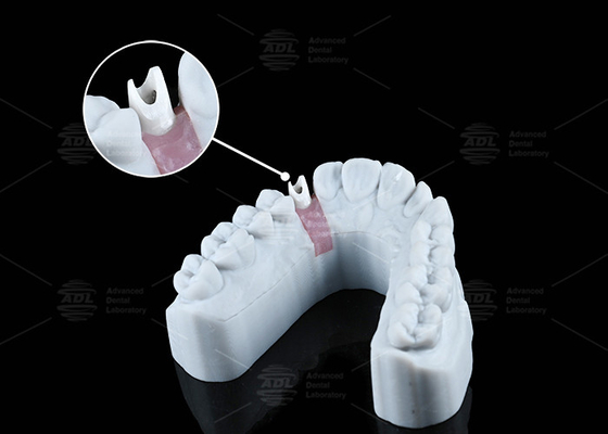 satın al Beyaz Özel Zirkonya Abutment Doğal Görünüm Estetiği ve Optimal İşlevsellik Çevrimiçi üretim