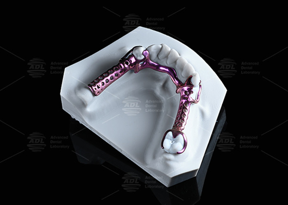 satın al Anodize 3D Titanyum Çerçeve Yüksek Güçlü Ve Hafif Ve Düzenlenebilir Çevrimiçi üretim