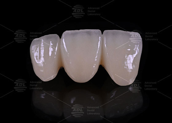 satın al Çin Diş Laboratuvarı Düzgün Düzgünlik Düzgünlik Kenarlıklar Katmanlı Zirkonya Hipoalerjenik Biyo uyumlu Dental Malzemeler Kalıcı ve Restorasyonlar İçin Çevrimiçi üretim
