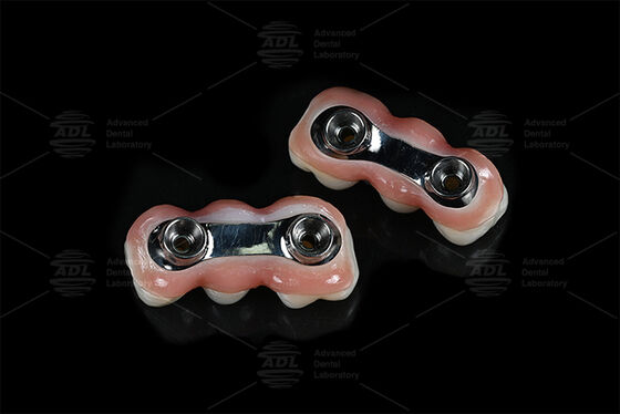 satın al Dental Restorasyon Çözümleri Sağlayan Çoğu Diş İmplantı Sistemiyle Uyumlu Çevrimiçi üretim