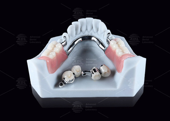 CEKA M2 Hızlı Bağlantı Titanyum 3 mm Yatay / Dikey Açıklıklarla