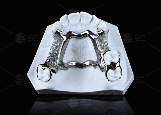 Kalıcı performans için açık sınıflı yüksek dayanıklılıklı 3D basılı titanyum çerçeve