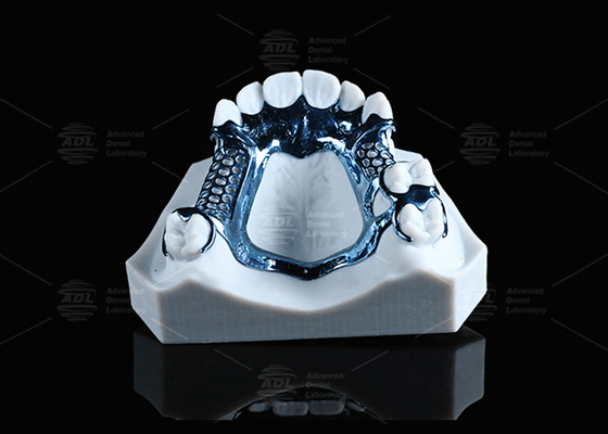 Anodize 3D basılı titanyum çerçeve hafif ve hassas cilt için uygundur