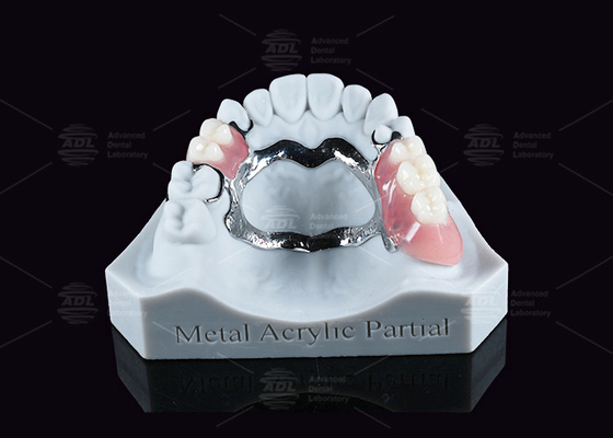 Kaldırılabilir Metal Akrilik Parçal Diş Dişleri