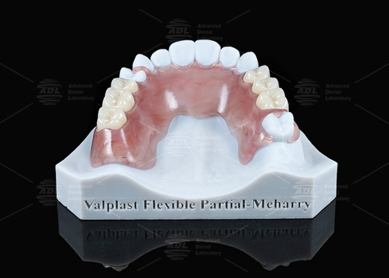 Hafif Valplast Esnek Kısmi Çok İyi Tutulabilir Pembe Ve Meharry