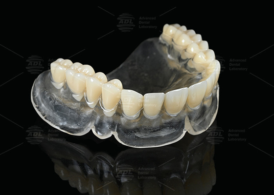 Sıcaklık iyileştirme Vertex Termose Dentürleri Açık Tam Dentür kullananlar için