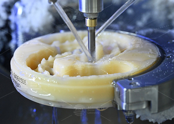 Kusursuz gülümsemeler için estetik ve doğal görünümlü bir dental protezin gücünü keşfedin.