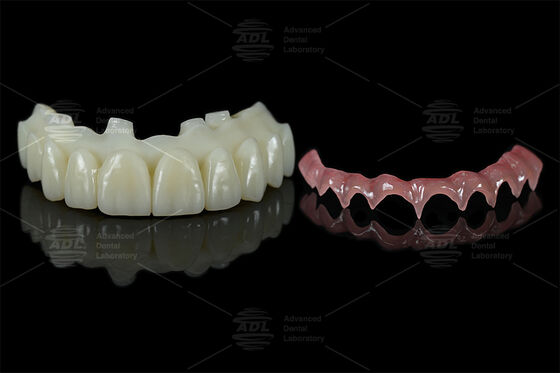 Çince Diş Laboratuvarı'ndan ALL ON X'in Doğrudan Yapımına Denemek İçin 3D Yazdırılmış Implant Destek Çubuğu
