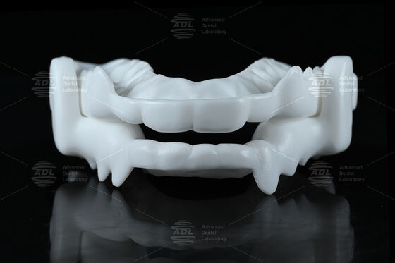 Nöbetçi CAD / CAM tasarımı ile tıbbi sınıflı Nylon Occlusal Splint Gece Koruyucusu